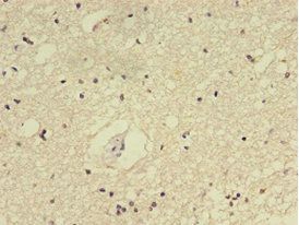 E2F2 Antibody