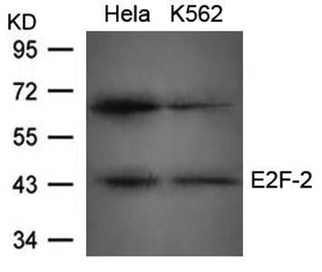 E2F-2 Rabbit Polyclonal Antibody