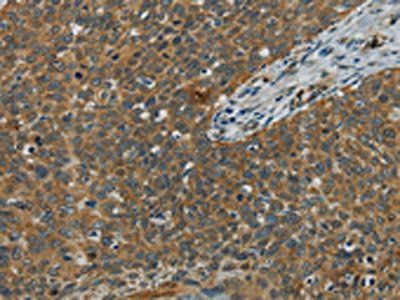 E2F6 Antibody