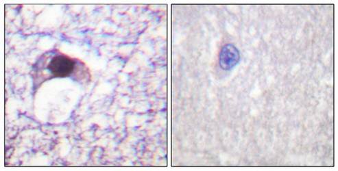 E2F6 Antibody