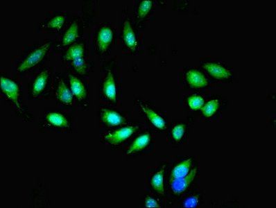 E3 ubiquitin-protein ligase MIB1 antibody