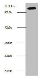 E3 ubiquitin-protein ligase MIB1 antibody