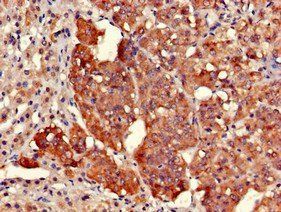 EARS2 Antibody
