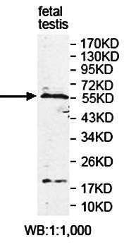 EARS2 Rabbit Polyclonal Antibody