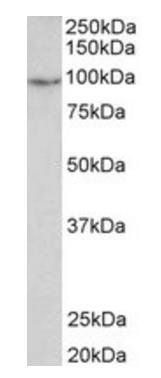 PDE4B Antibody