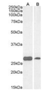Goat anti-PGAM1 / PGAM2 / PGAM4 Antibody