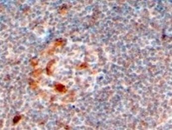 ZCCHC11/PAPD3 Antibody