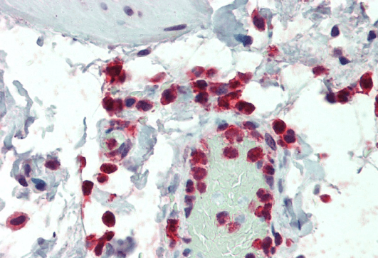 Goat anti-NCF1 / p47phox Antibody