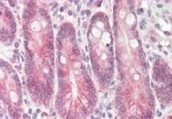 Goat anti-STAP2 / BKS (aa391-403) Antibody