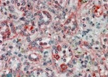 Goat anti-TXNDC1 / TMX Antibody