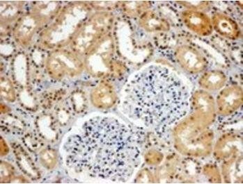 WHIP/WRNIP1 Antibody