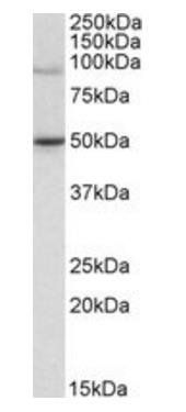 WHIP/WRNIP1 Antibody
