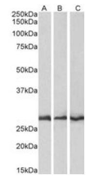 Goat anti-CAPZB Antibody