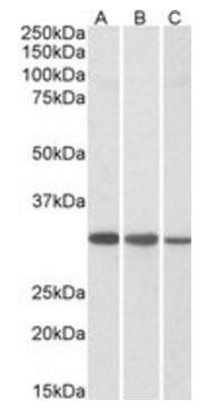 Goat anti-CAPZB Antibody