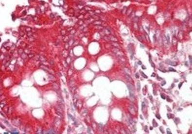 Goat anti-BIF-1 / SH3GLB1 Antibody