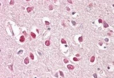 Goat anti-BAIAP2 (isoform 3) Antibody