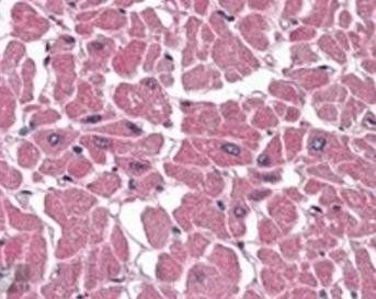 Goat anti-BPOZ / ABTB1 Antibody