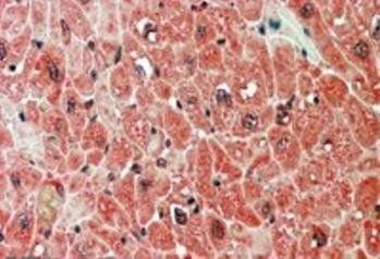 Goat anti-PPP2R5A Antibody