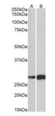 Goat anti-ATF5 Antibody
