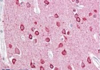 Goat anti-PACSIN1 Antibody