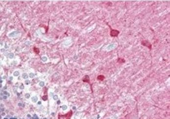 Goat anti-PACSIN1 Antibody