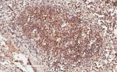 Goat anti-GRB2 Antibody