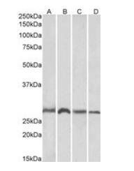Goat anti-SIAH1 Antibody