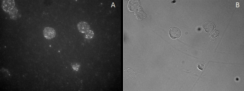 FOXP3 antibody