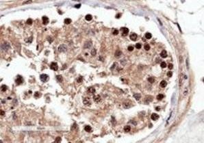 Goat anti-RACGAP1 / MgcRacGAP Antibody