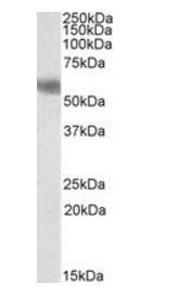 Goat anti-DUSP8 / HVH5 Antibody