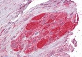 Goat anti-STUB1 / CHIP Antibody
