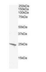 BAK1 Antibody