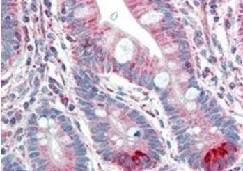 Goat anti-Spinesin / TMPRSS5 Antibody