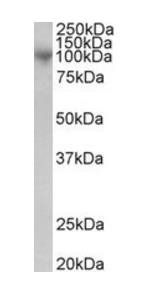 Goat anti-MS2 / ADAM8 / CD156 Antibody