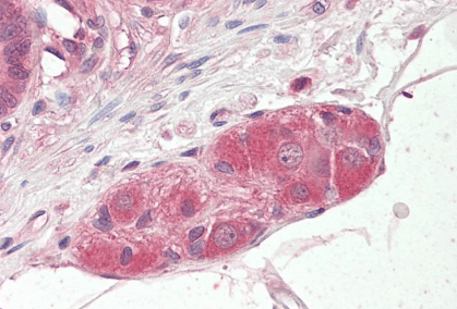 Goat anti-KLF8 / BKLF3 Antibody