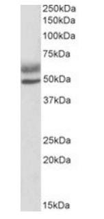 AIRE antibody