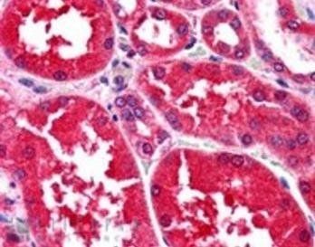 Goat anti-Aldehyde Reductase Antibody
