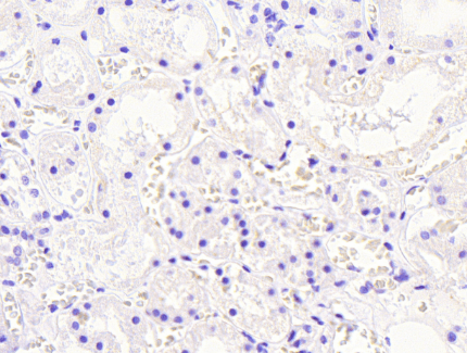 Goat anti-Aldehyde Reductase Antibody