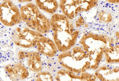 Goat anti-Aldehyde Reductase Antibody