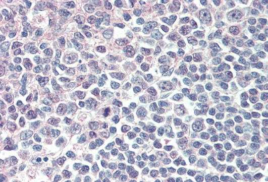 Goat anti-ICSBP1 / IRF8 Antibody