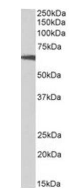 Goat anti-p70S6K / RPS6KB1 Antibody