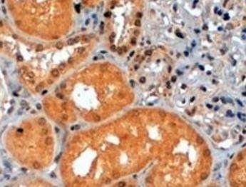 Goat anti-p70S6K / RPS6KB1 Antibody