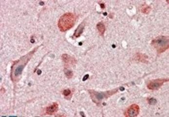 Goat anti-HIP2 Antibody