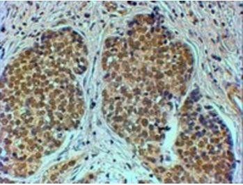 TIF1A/TRIM24 Antibody