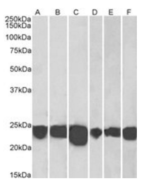 Goat anti-PARK7 / DJ-1 Antibody
