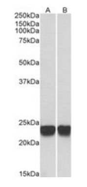 Goat anti-PARK7 / DJ-1 Antibody