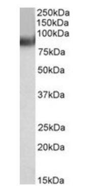 MURF2/TRIM55 Antibody