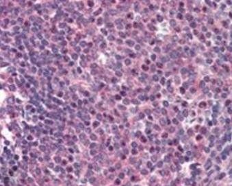Goat anti-CARD11 Antibody