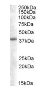 Goat anti-SNX16 Antibody