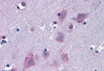 Goat anti-TRIM2 Antibody